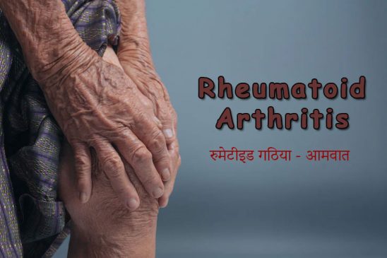 Orthayu Balm in rheumatoid arthritis